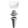 tooth fixture